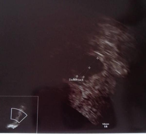 Bild zu 5+5 - Forum für Juli - Mamis