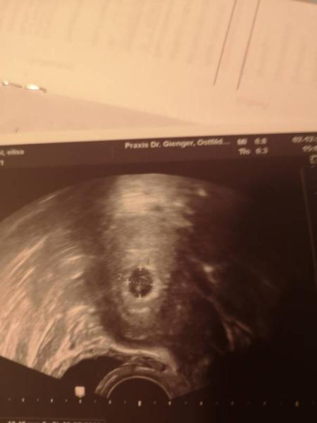 Bild zu 1 FA Termin bei 5+5 - Forum für Juli - Mamis