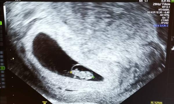 Bild zu Flips geht's super - Forum für Juli - Mamis