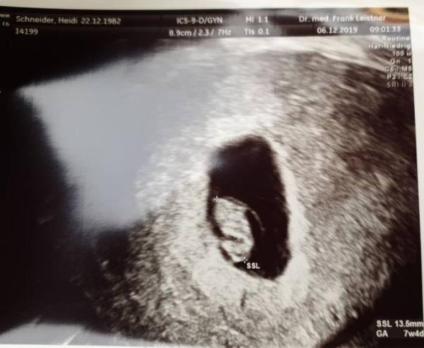 Bild zu Unser Herzchen schlägt auch kräftig. - Forum für Juli - Mamis