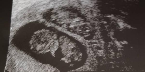 Bild zu Die 2 Süßen - Forum für Juli - Mamis