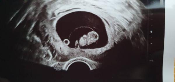 Bild zu Wir können unser Glück kaum fassen! - Forum für Juli - Mamis