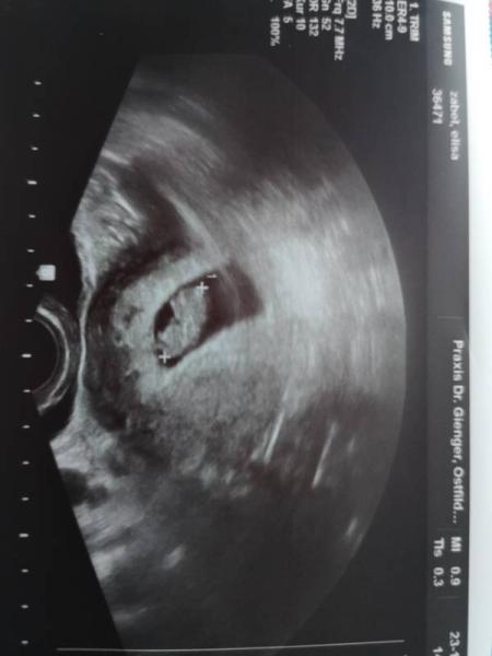 Bild zu Erleichtert. Unserer Peanut geht's super. 😅 - Forum für Juli - Mamis