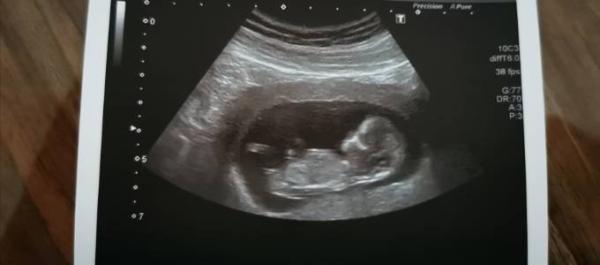 Bild zu Kritische Phase vorbei - Forum für Juli - Mamis