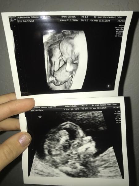 Bild zu 2. Ultraschall ssw 12 + 5 - Forum für Juli - Mamis