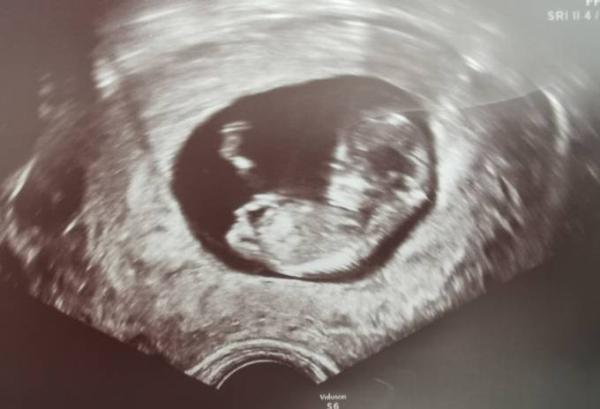 Bild zu 1. Großer Ultraschall - Forum für Juli - Mamis
