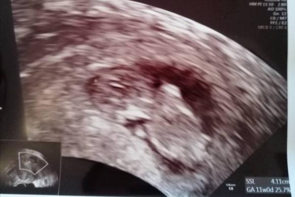 Bild zu 1.Screenig - Forum für Juli - Mamis