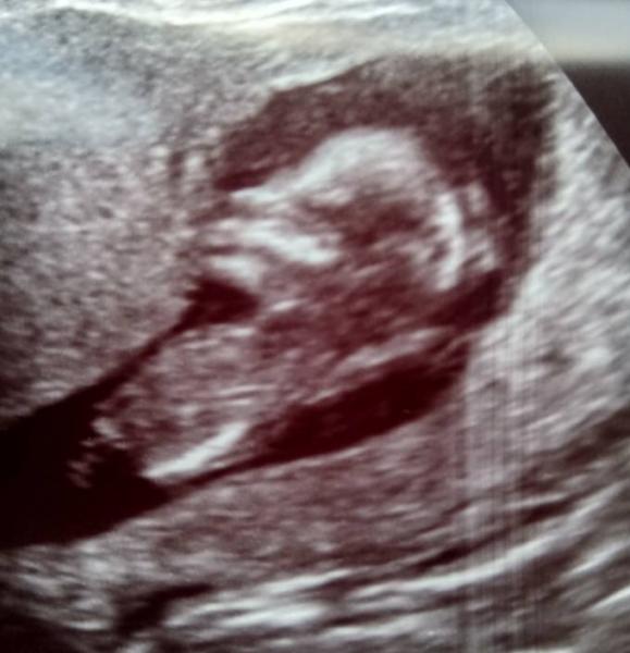 Bild zu Hallo 4. Monat... - Forum für Juli - Mamis