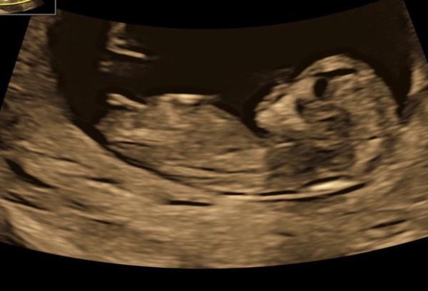 Bild zu Junge oder Mädchen?  - Forum für Juli - Mamis