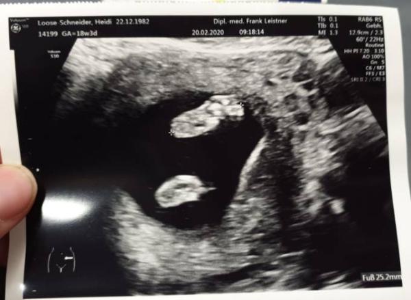 Bild zu Prinzessin Update - Forum für Juli - Mamis