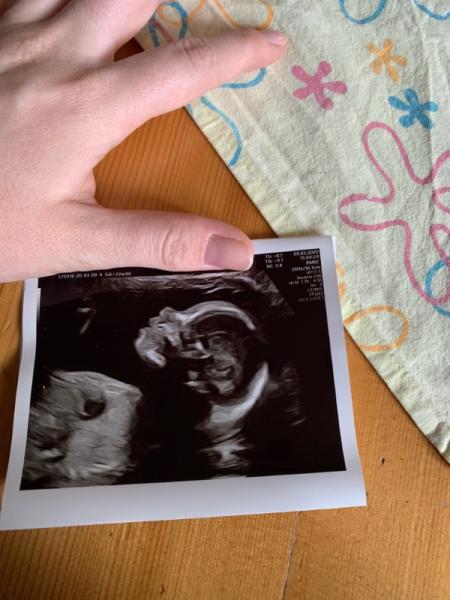 Bild zu Verspätete Feindiagnostik - Forum für Juli - Mamis
