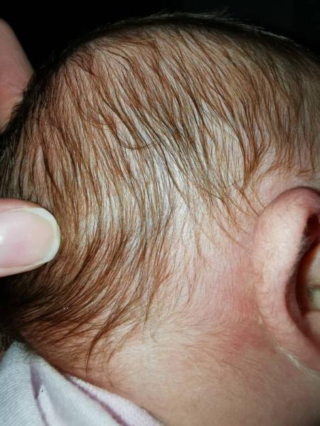 Bild zu Hintere Seitenfontanelle - Forum für Juli - Mamis