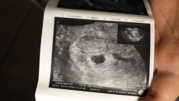 Bild zu Ultraschall bild 😍 - Forum für Juli - Mamis