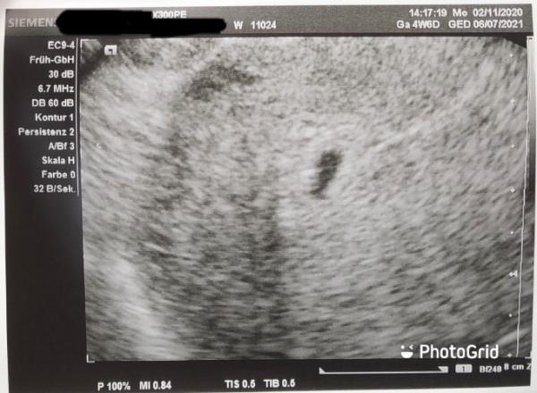 Bild zu Erstes Bild - Forum für Juli - Mamis