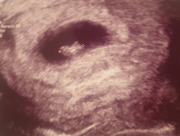 Bild zu Zurück vom FA - Forum für Juli - Mamis