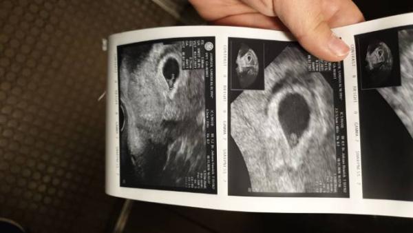 Bild zu HERZSCHLAG - Forum für Juli - Mamis