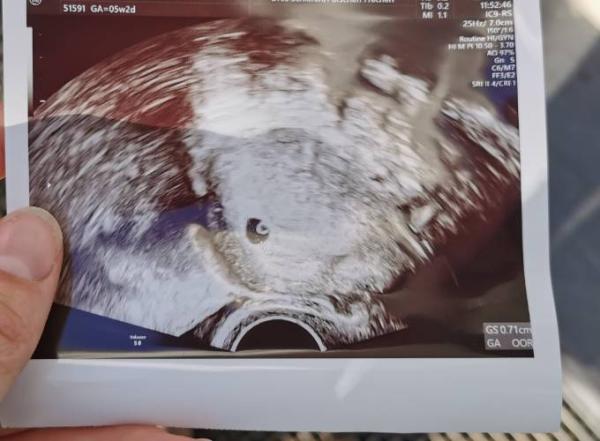 Bild zu 1. Termin US - Forum für Juli - Mamis