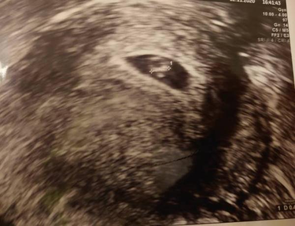 Bild zu Herzschlag - Forum für Juli - Mamis