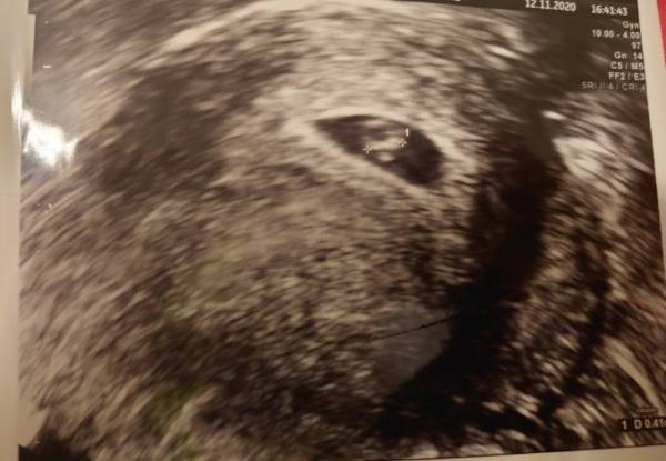 Bild zu Herzschlag - Forum für Juli - Mamis