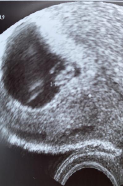 Bild zu Zurück vom Arzt.. - Forum für Juli - Mamis