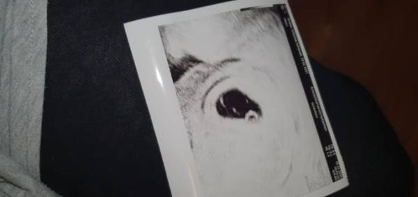 Bild zu 1 FA Termin - Forum für Juli - Mamis