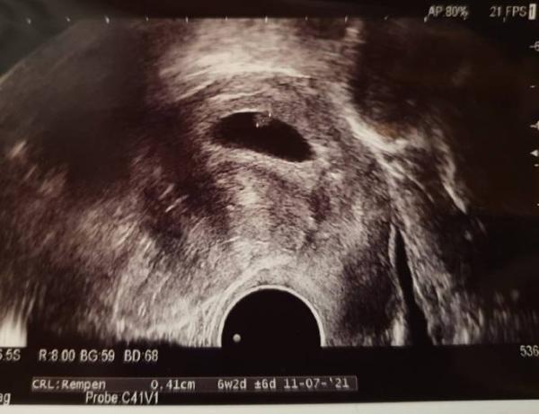 Bild zu FA-Termin vorgestern - Forum für Juli - Mamis