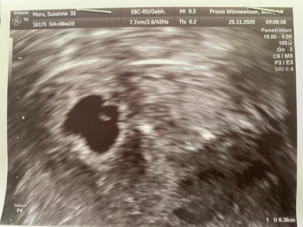 Bild zu In ungünstige Ecke eingenistet - Forum für Juli - Mamis