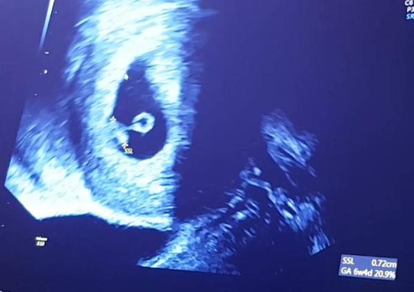 Bild zu Kleines Update - Forum für Juli - Mamis