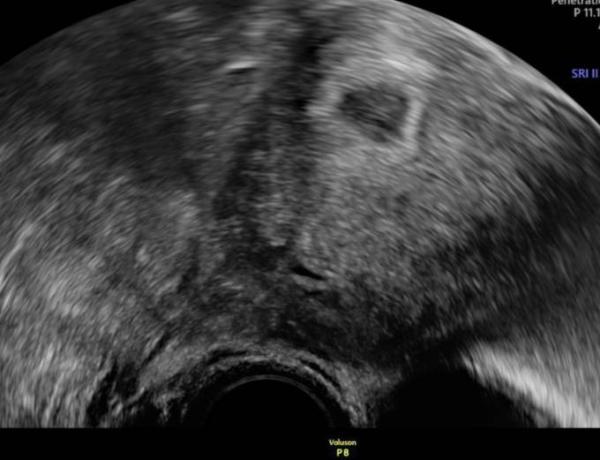 Bild zu Heute Termin bei 5+2 - Forum für Juli - Mamis