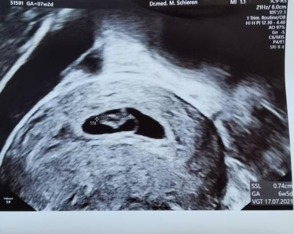 Bild zu Update 2. Termin FÄ - Forum für Juli - Mamis