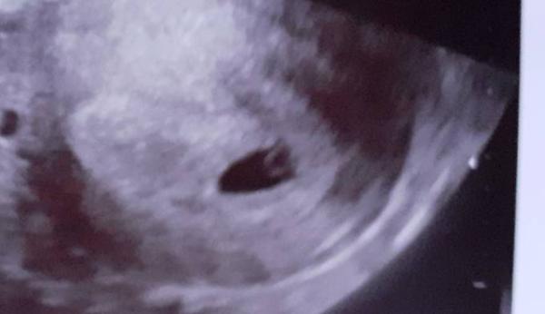 Bild zu Erster Termin 🥰 - Forum für Juli - Mamis