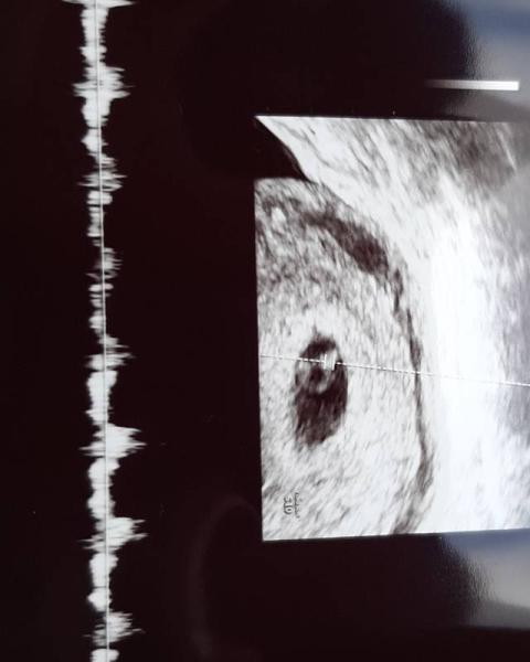 Bild zu Ultraschall 😍 - Forum für Juli - Mamis