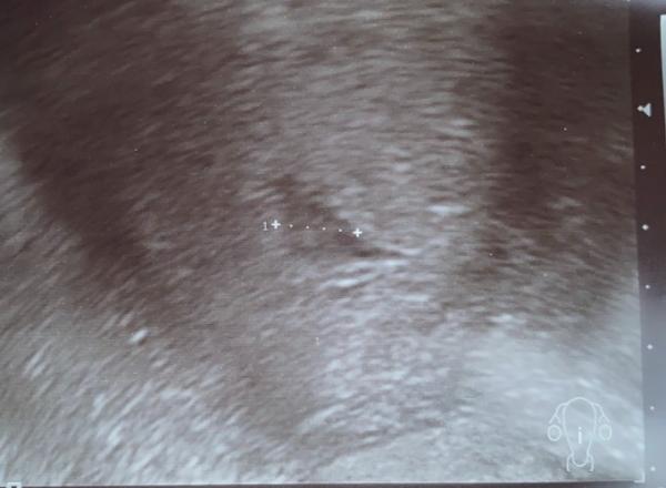 Bild zu Heute FA Termin gehabt - Forum für Juli - Mamis