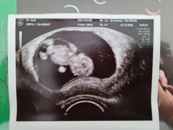 Bild zu Heute war FA- Termin - alles super! - Forum für Juli - Mamis