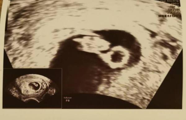 Bild zu Update von uns < 3 - Forum für Juli - Mamis