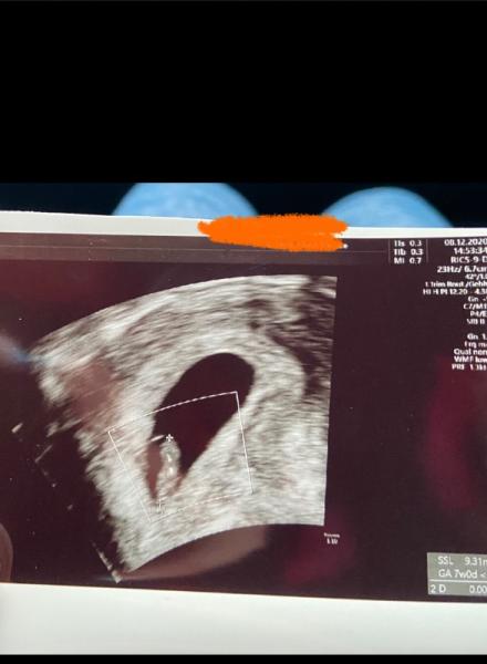 Bild zu Herzchen 🥰 schlägt - Forum für Juli - Mamis