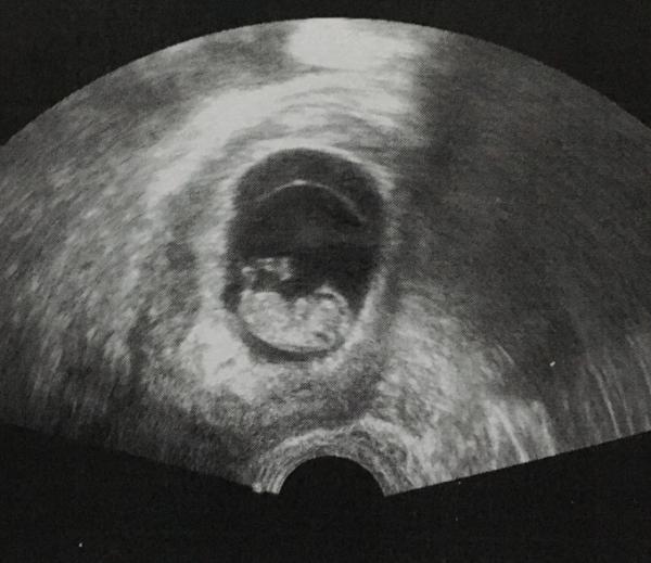 Bild zu Überglücklich 😍 - Forum für Juli - Mamis