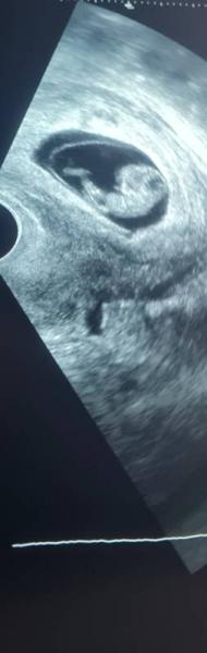 Bild zu Hallo zusammen:) - Forum für Juli - Mamis