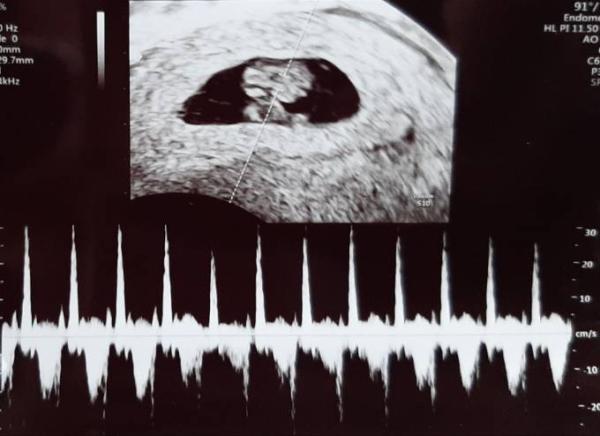 Bild zu Freude teilen - FA Termin😍 - Forum für Juli - Mamis