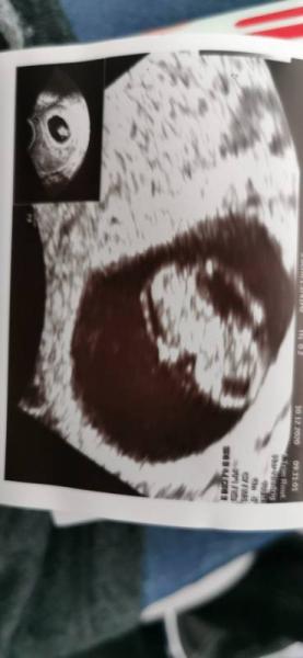 Bild zu 2.Termin< 3 - Forum für Juli - Mamis