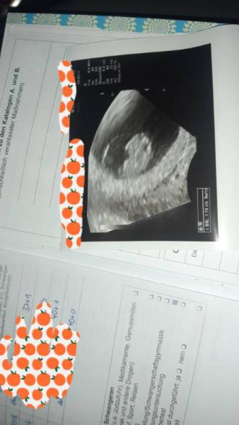 Bild zu Erster Ultraschall - Forum für Juli - Mamis