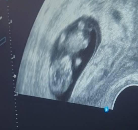 Bild zu Freude:) - Forum für Juli - Mamis