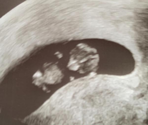 Bild zu Ich bin auch happy.. neues Bild 😍 - Forum für Juli - Mamis