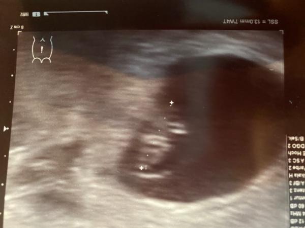 Bild zu FA Termin - Forum für Juli - Mamis