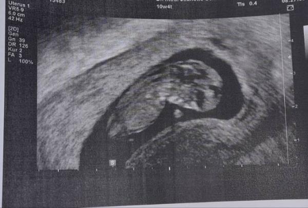 Bild zu Über Glücklich - Forum für Juli - Mamis