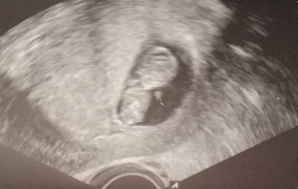 Bild zu Baby geht es gut - Forum für Juli - Mamis