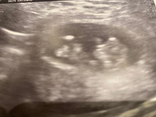 Bild zu Super Baby - Forum für Juli - Mamis