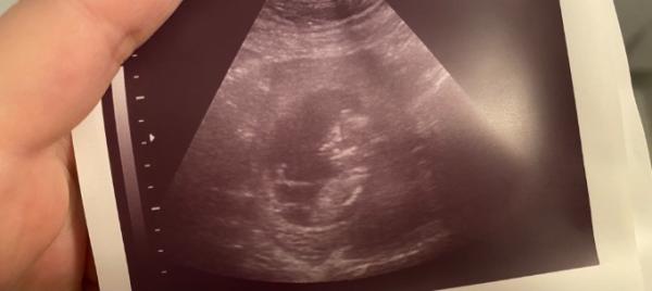 Bild zu Geschlecht? - Forum für Juli - Mamis