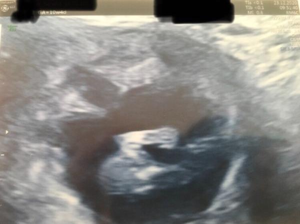 Bild zu zurück von FÄ - Forum für Juli - Mamis