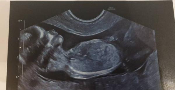 Bild zu Auch zurück vom Doc ❤ - Forum für Juli - Mamis